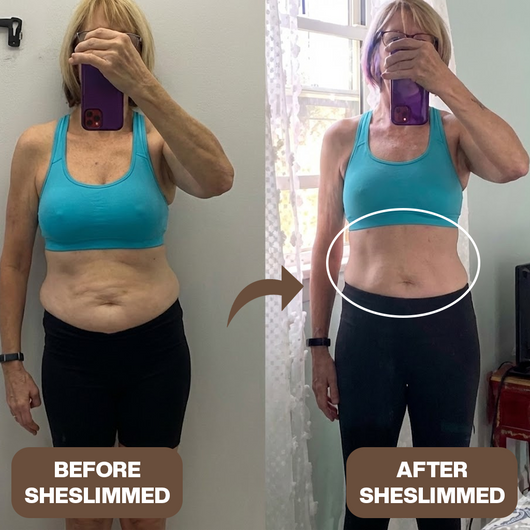 The SheSlimmed™ Belt