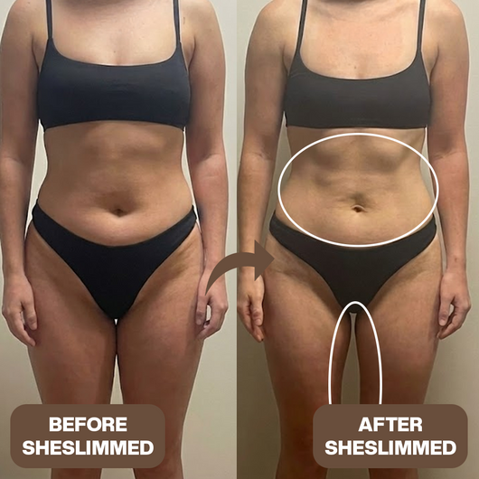 The SheSlimmed™ Belt