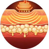 Deep Heat Penetration Melts Fat Layers